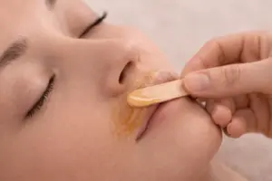 Harsen bovenlip | Skin in Balance